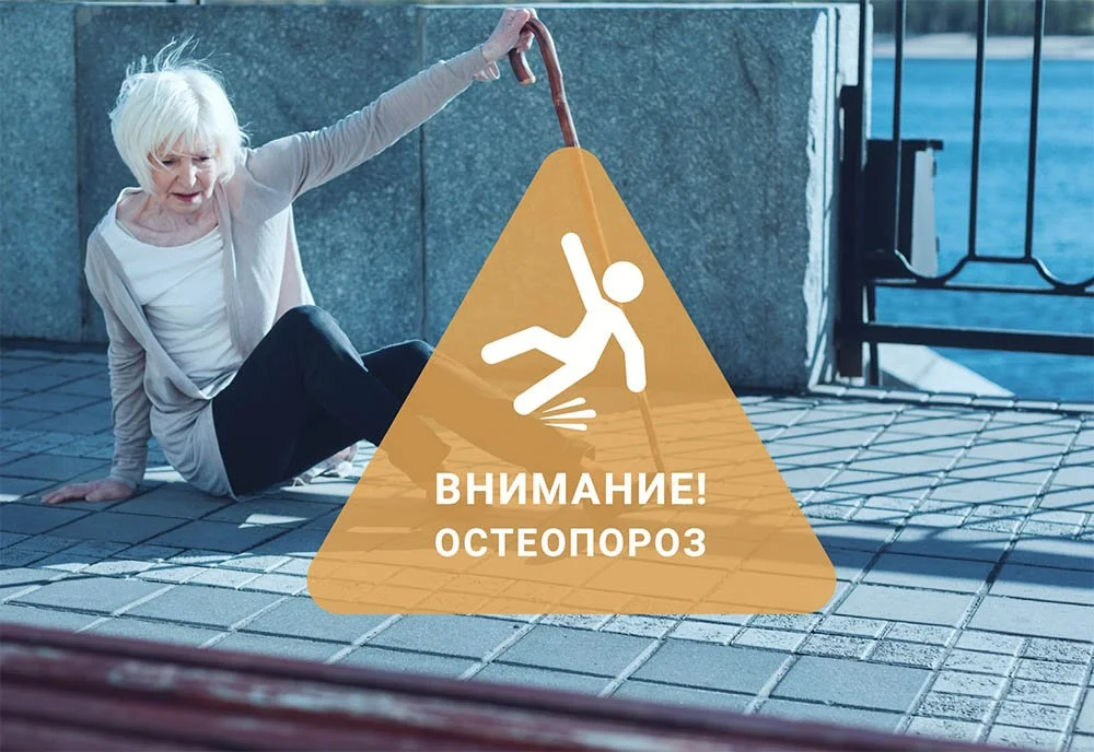 Остеопороз - уменьшите ваш риск падений и переломов